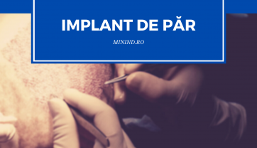 IMPLANT DE PAR