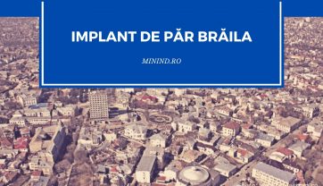 Implant de par Braila