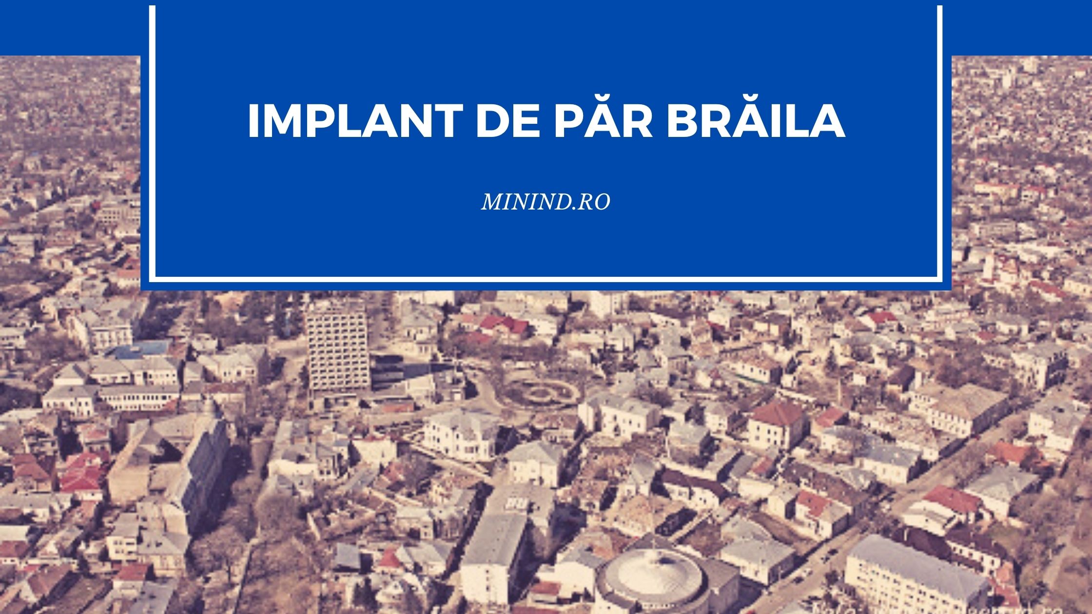 implant de par braila