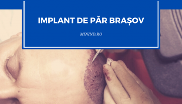 Implant de par Brasov