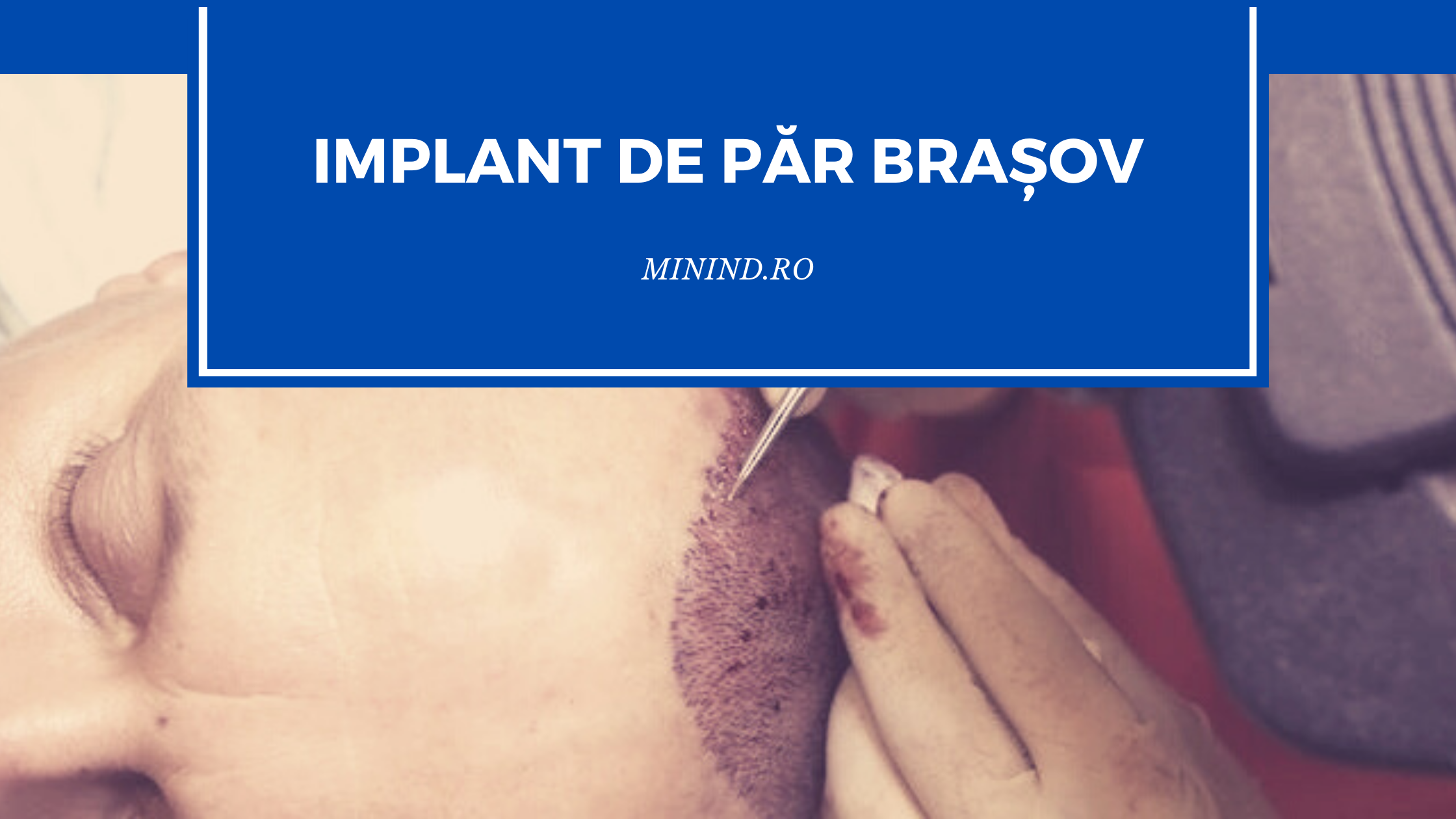 implant de par brașov