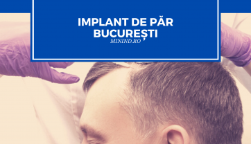 Implant de par Bucuresti