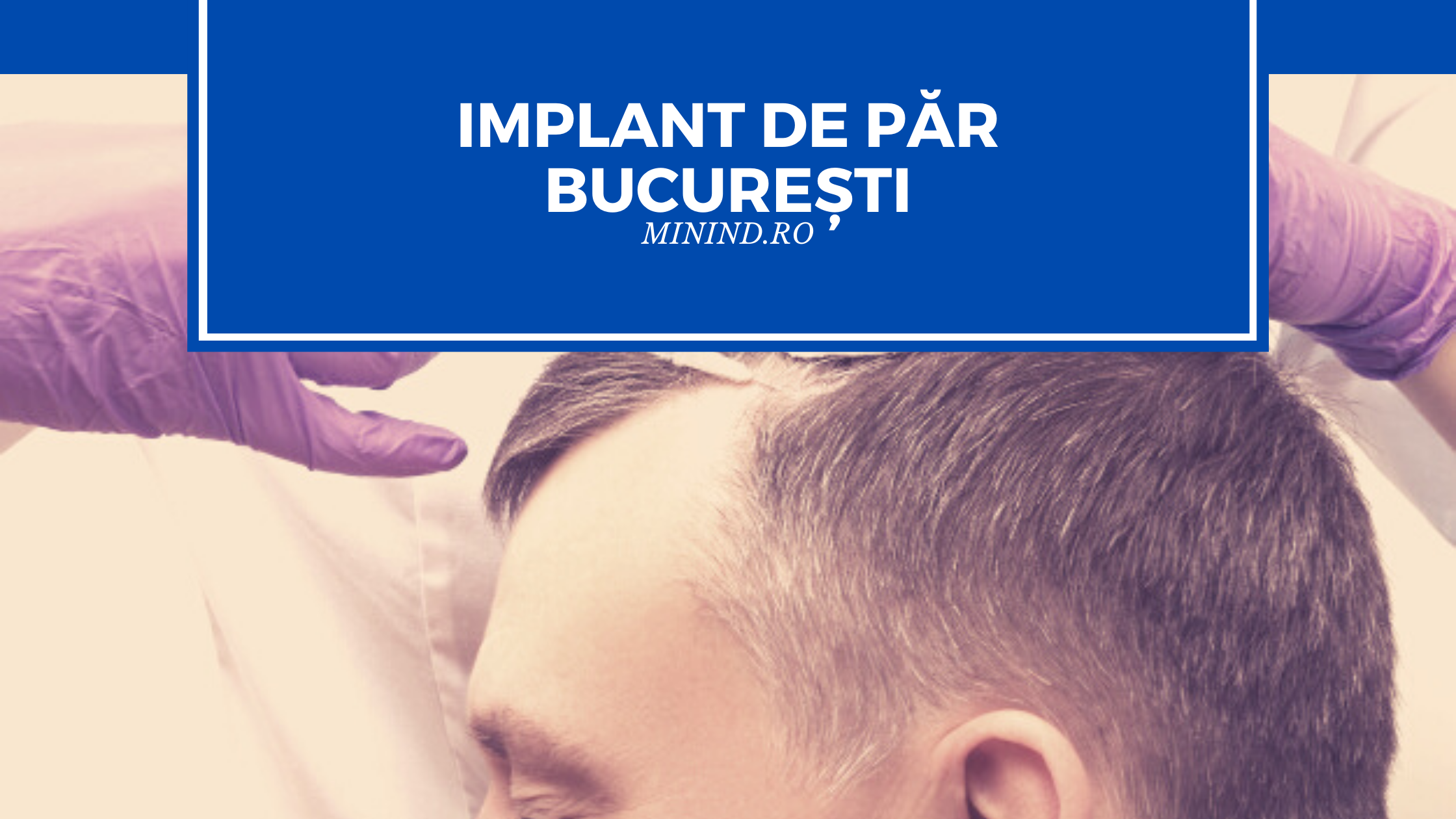 implant de par bucuresti