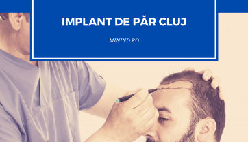 Implant de par Cluj