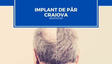 Implant de par Craiova