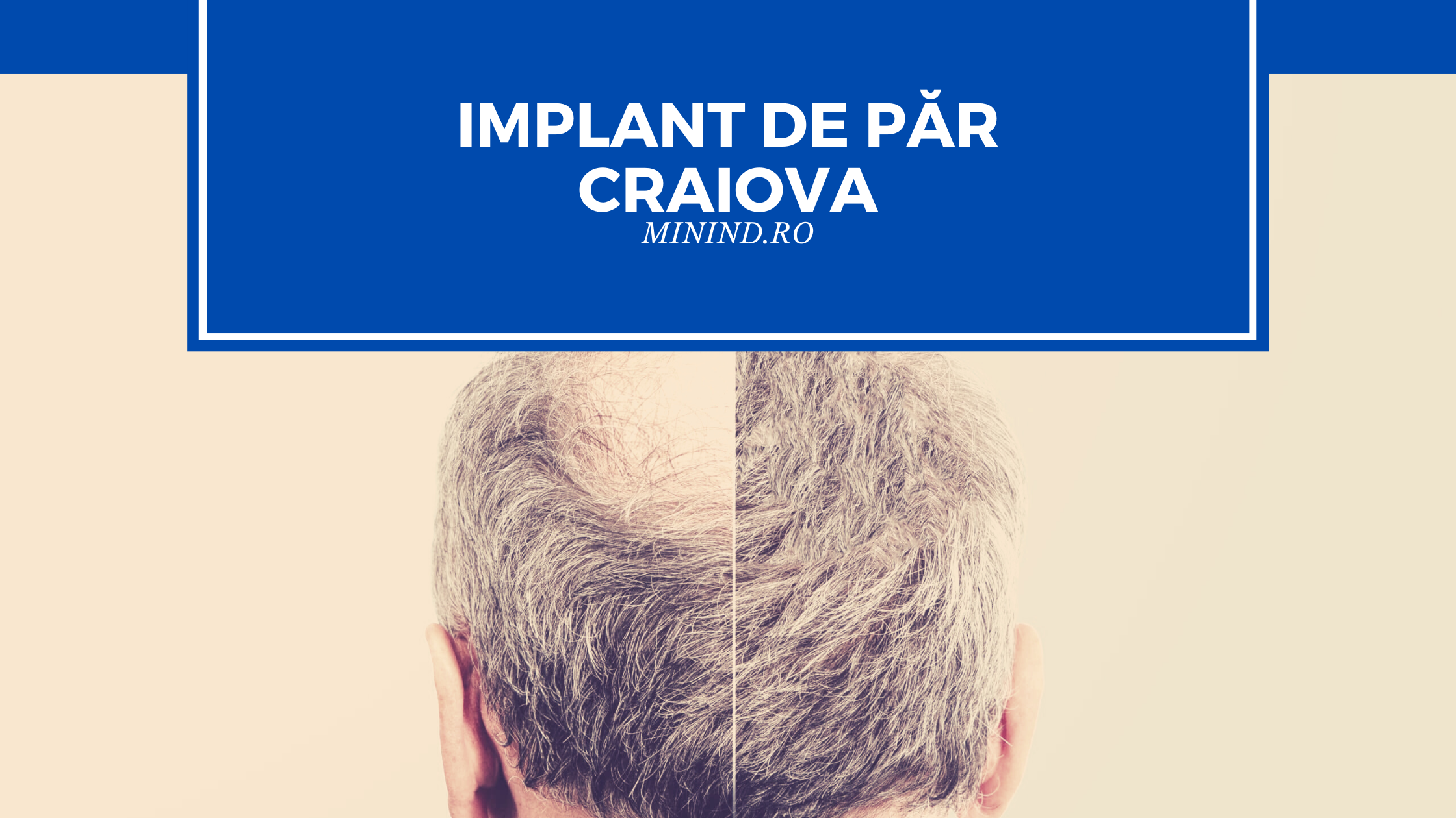 implant de par craiova