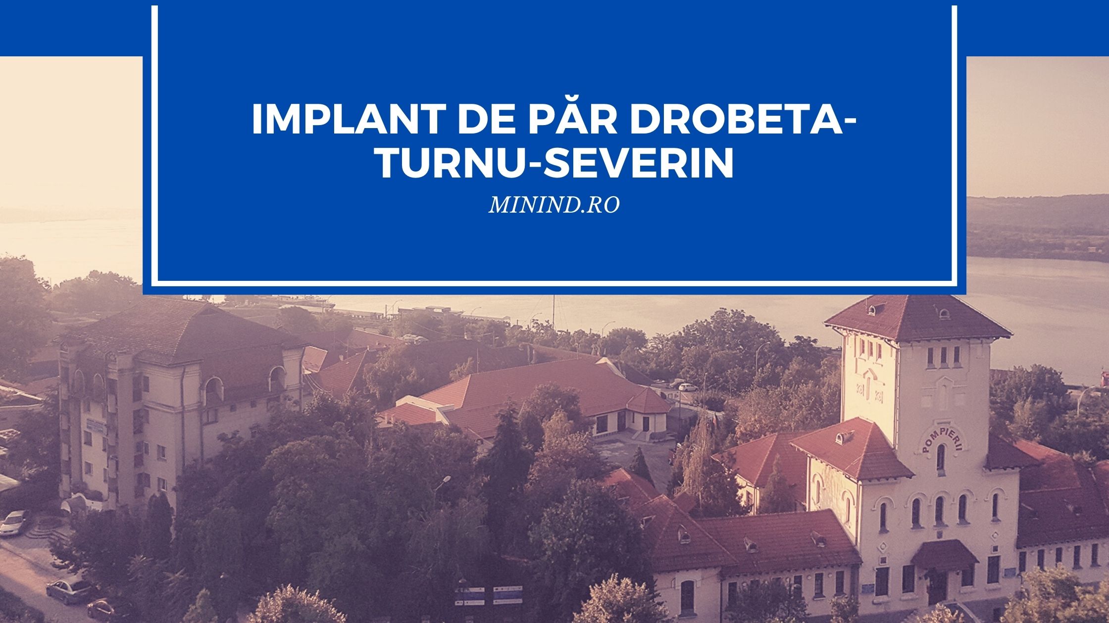 implant de par drobeta turnu severin