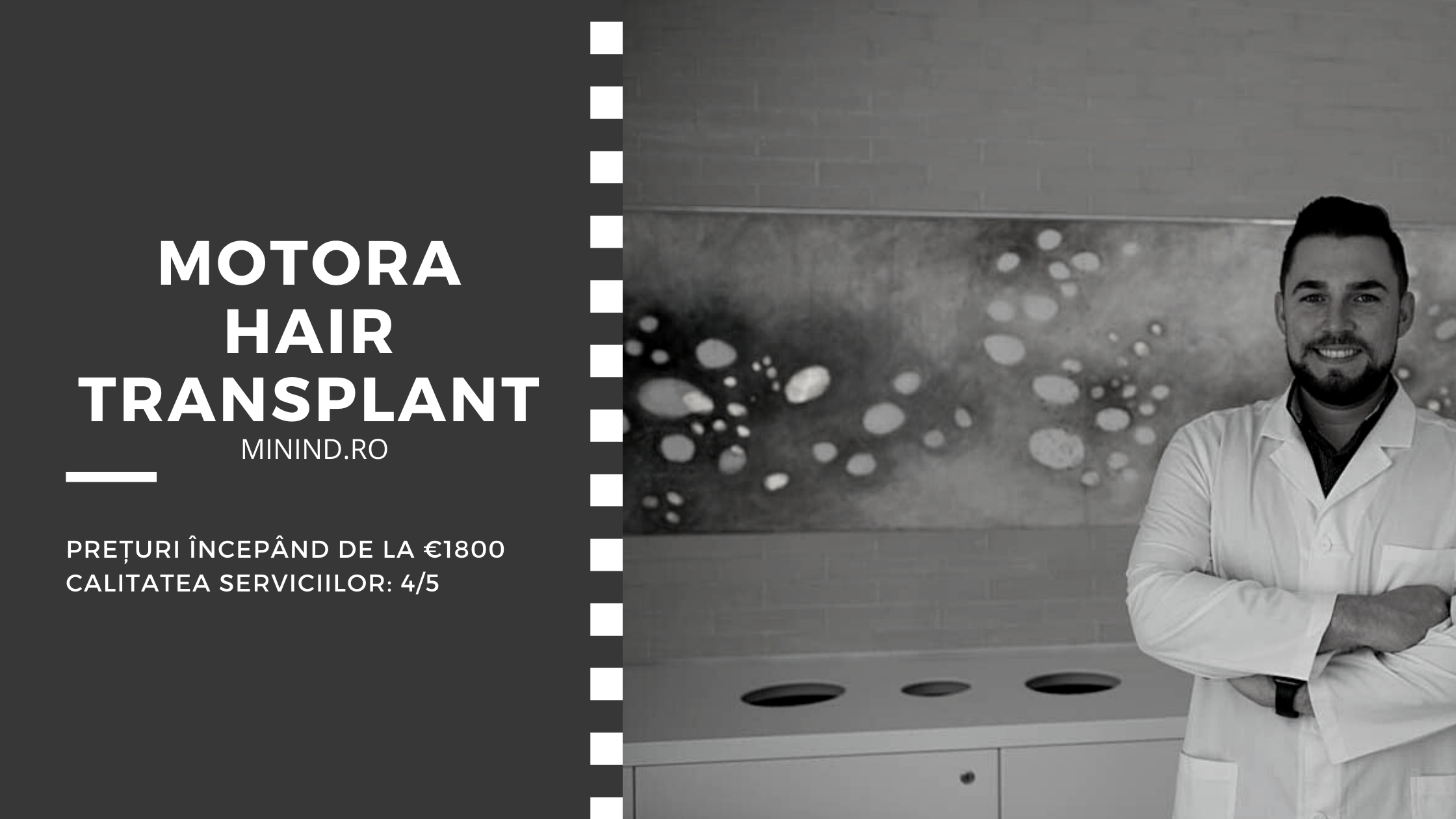 implant de par motora hair