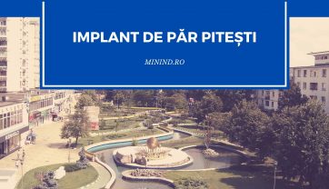 Implant de par Pitesti