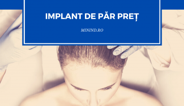 Implant de Par Pret