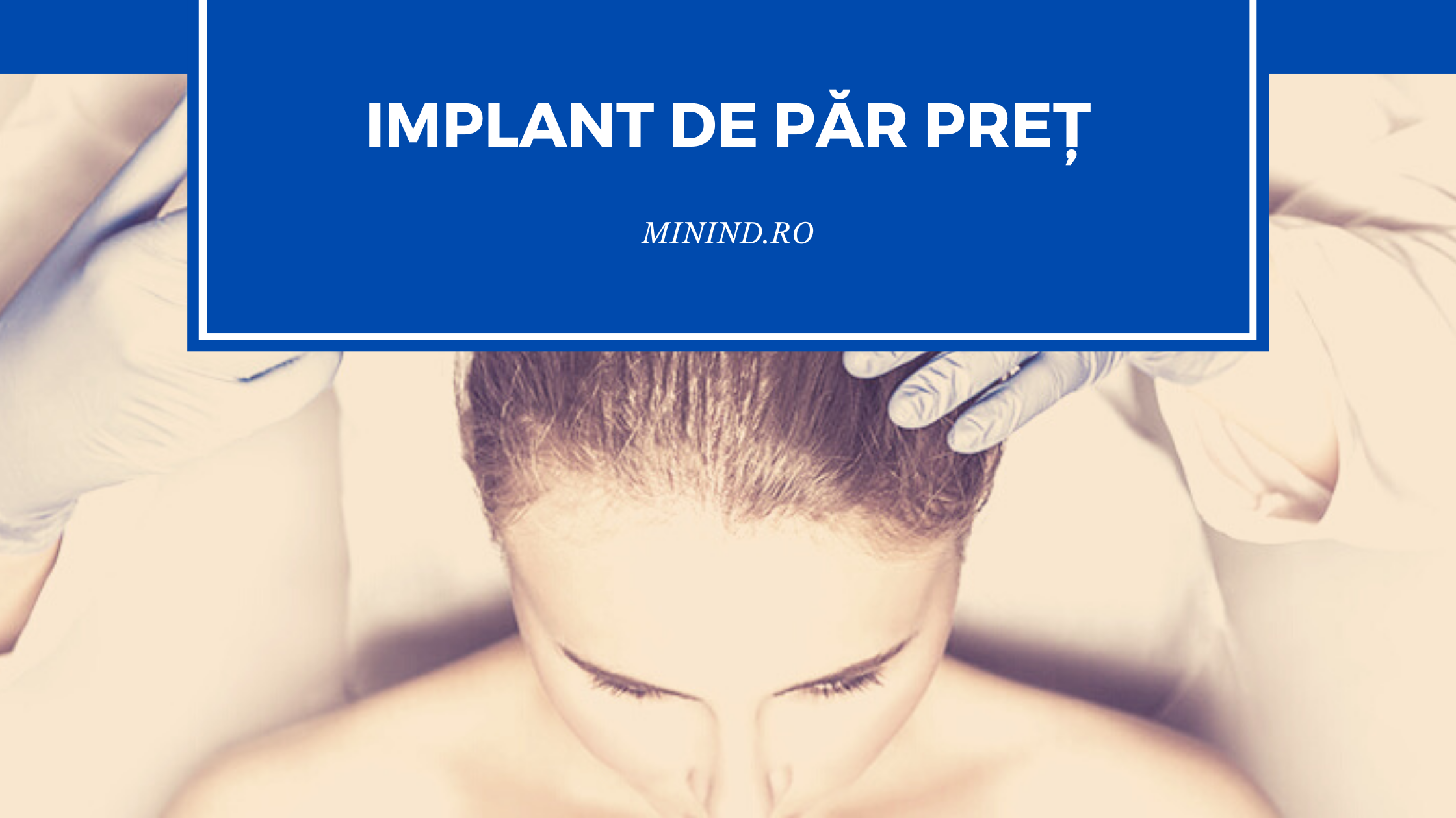 implant de par pret