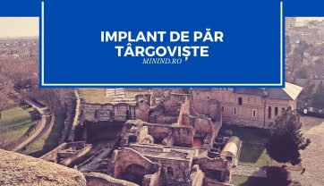 Implant de par Targoviste