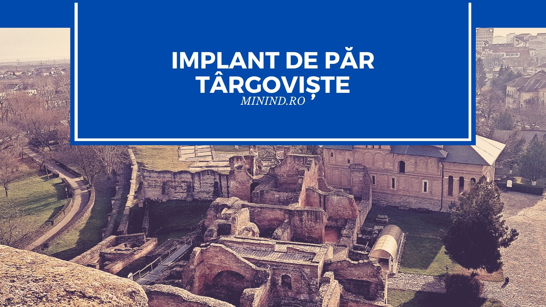 implant de par targoviste