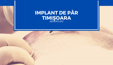 Implant de par Timisoara