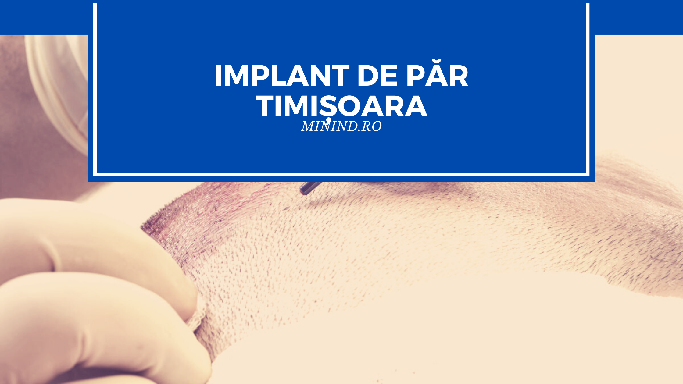 implant de par timisoara