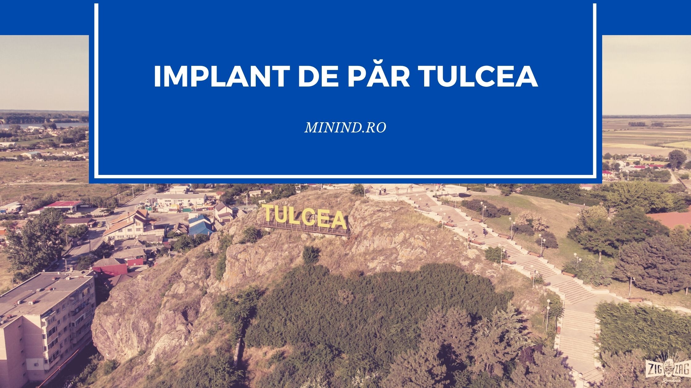 implant de par tulcea