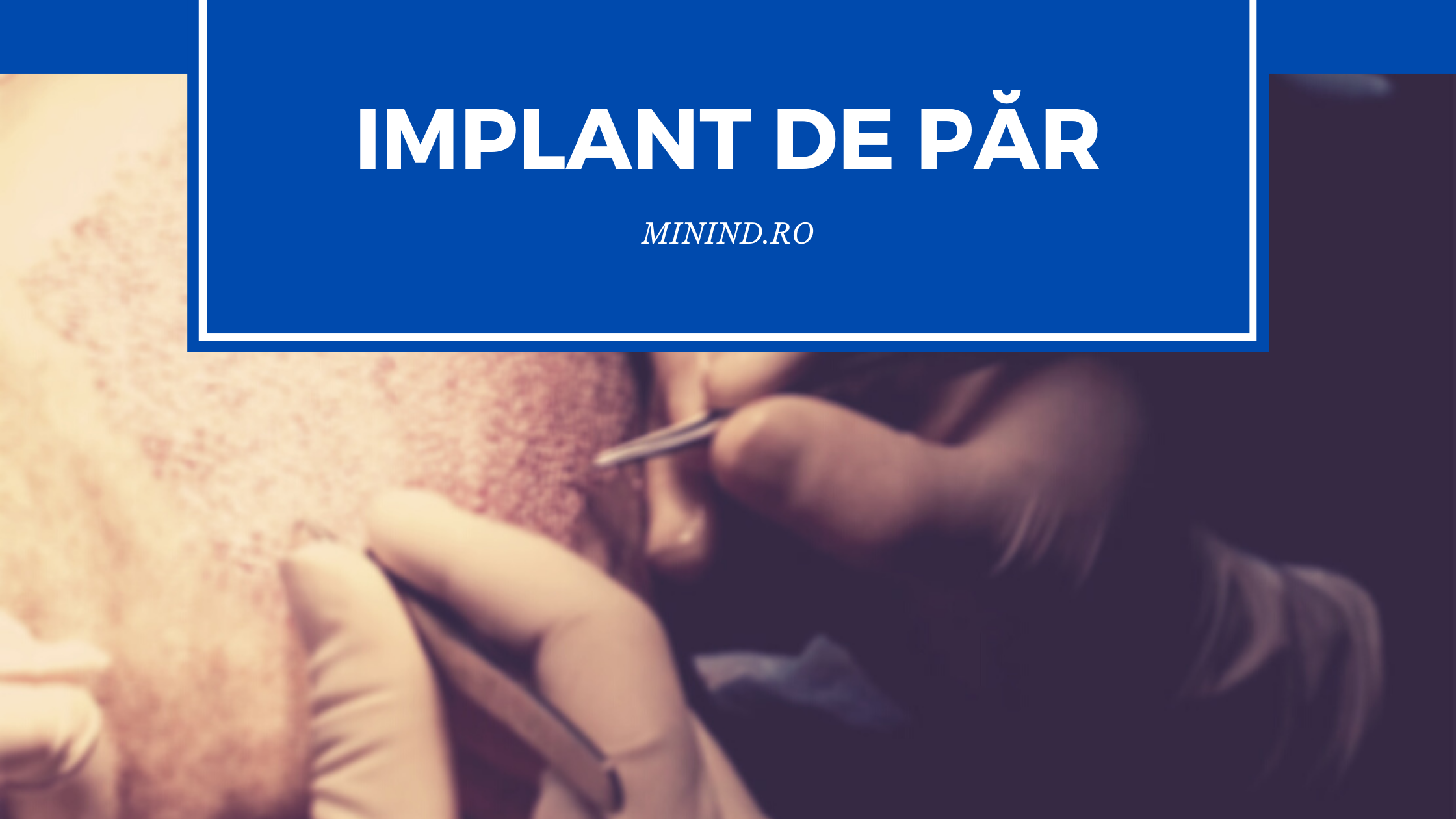 implant de par